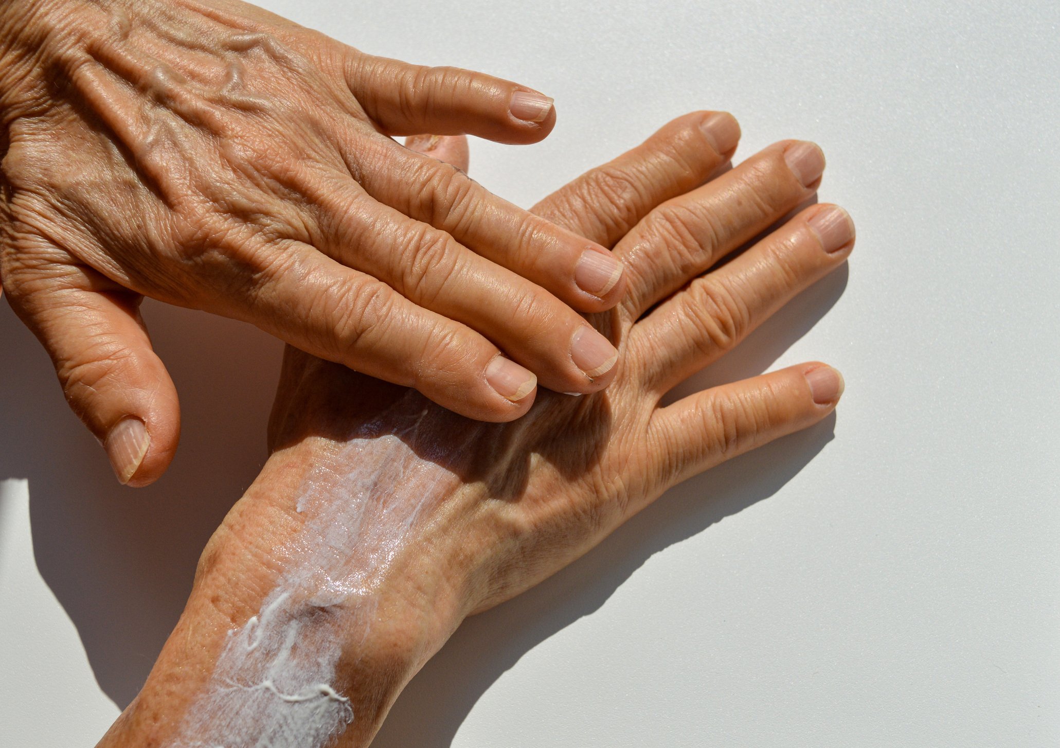 Age spots, liver spots, skin cancer, UV protection, melanoma
